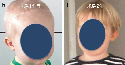 案例来源：巴教授国内演讲案例