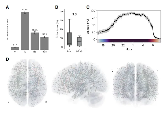 聚合睡眠和尖波指标及电极覆盖图