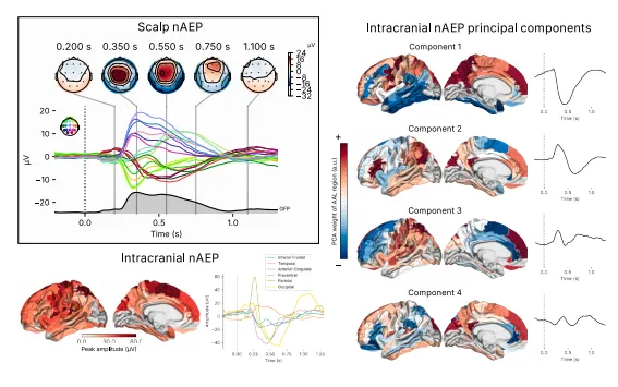 Intracranial nAEP principal components
