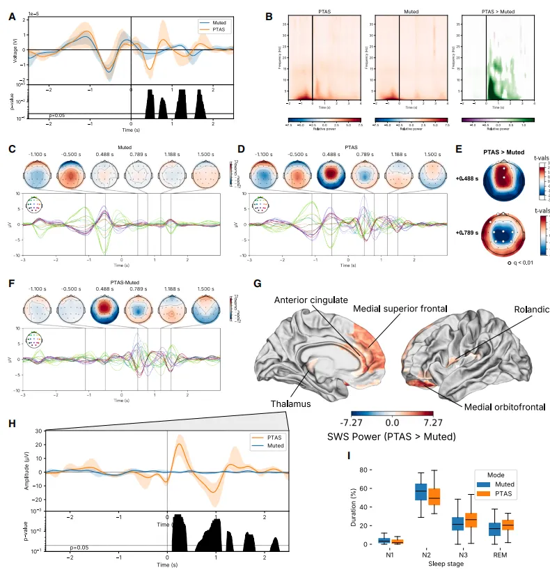 上升相位PTAS增加癫痫儿童的慢波振幅