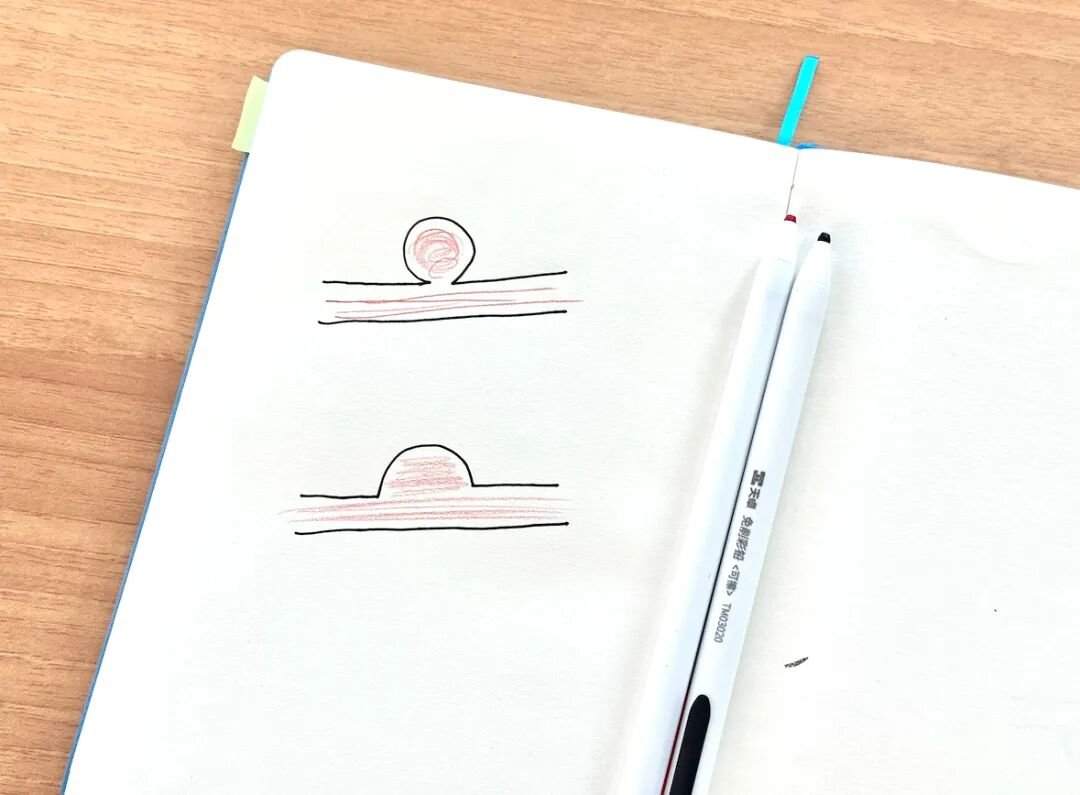 下图瘤颈宽大，弹簧圈难以稳定驻留