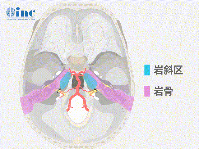 岩斜区肿瘤术后致残率高？有办法安全切除吗？ 