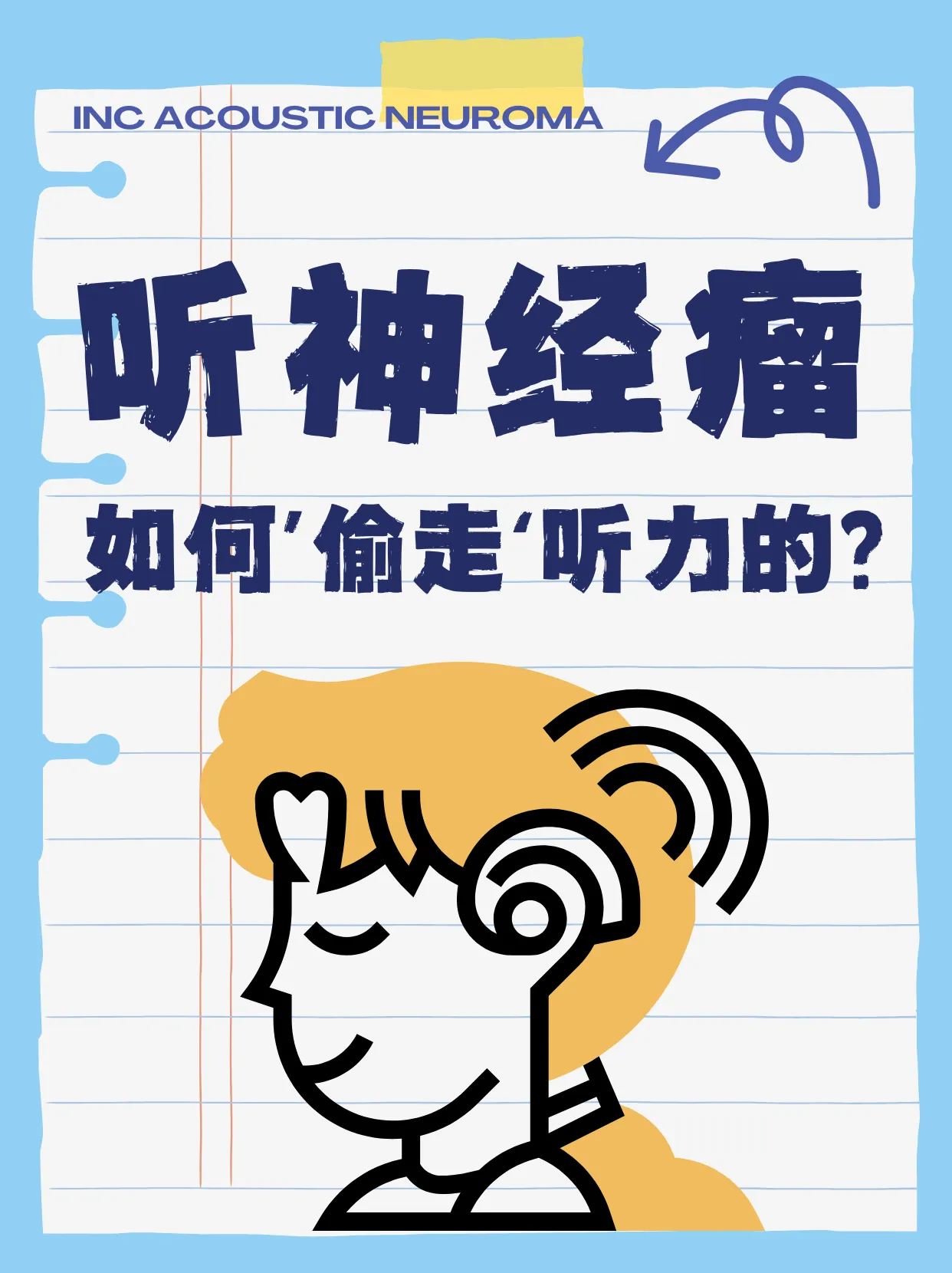 听神经瘤