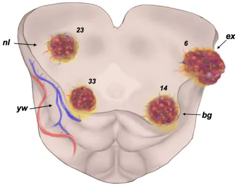深藏型病灶，预后或更优