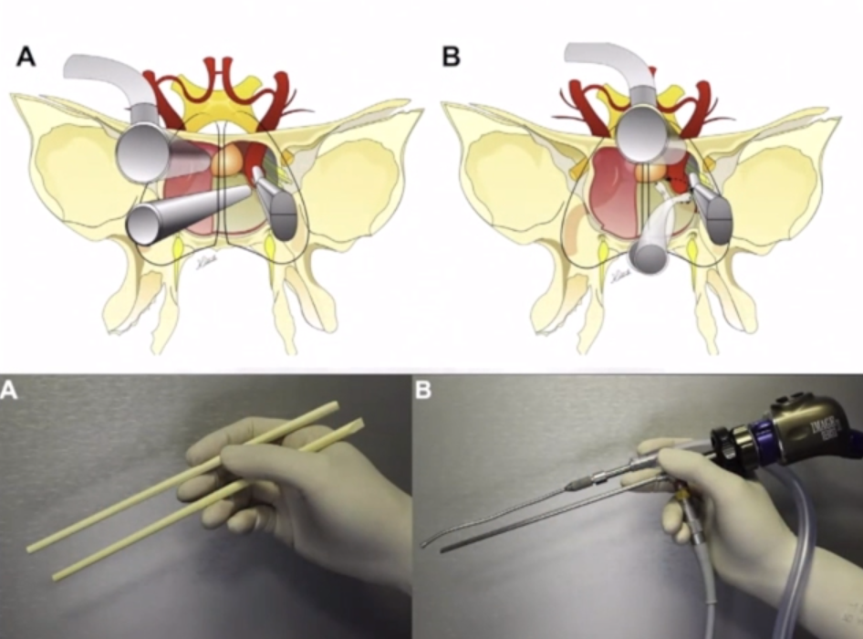 筷子技术示意图
