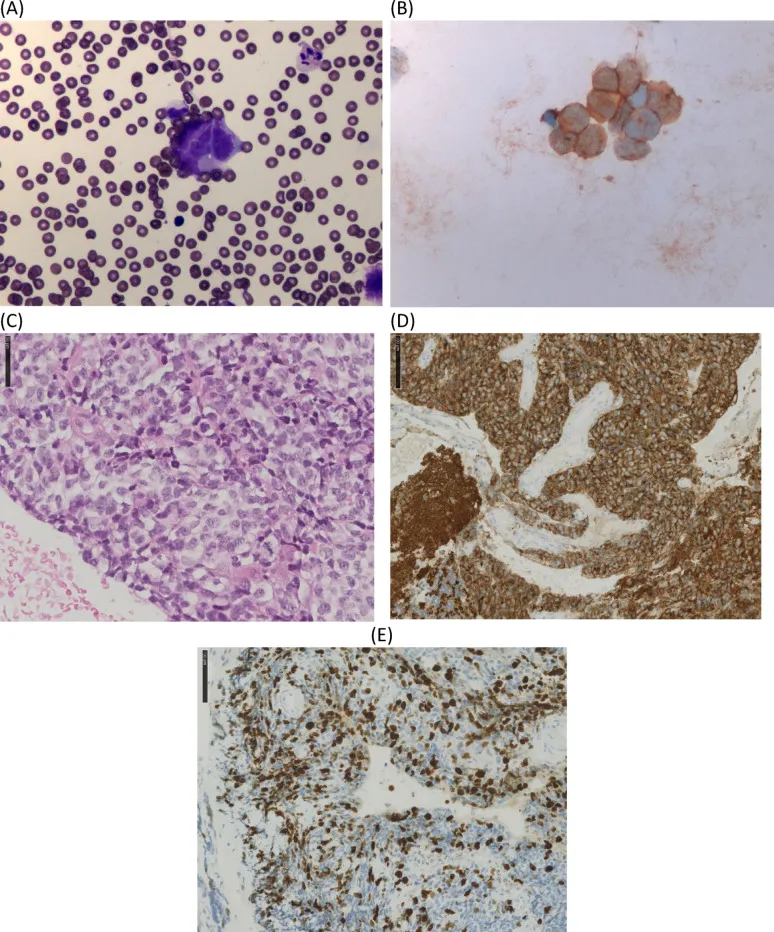 图：病理学检查结果。