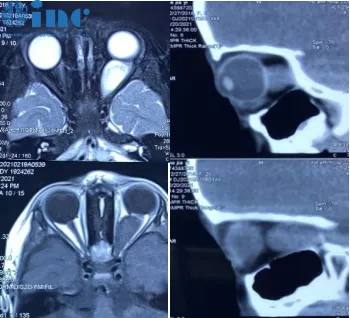 Di Rocco教授咨询邮件回复