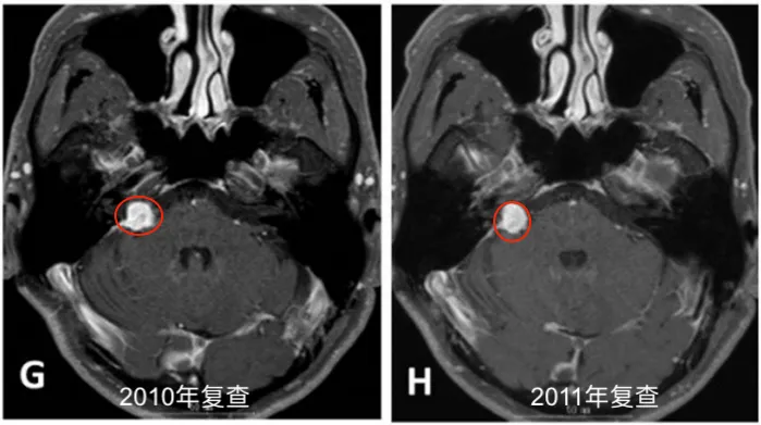 2010年复查，2011年复查