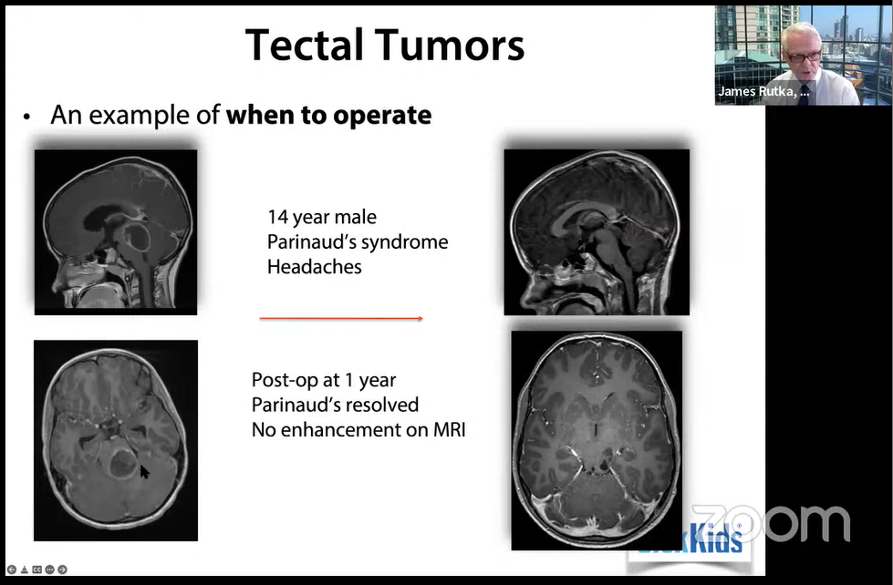 鲁特卡教授演讲案例