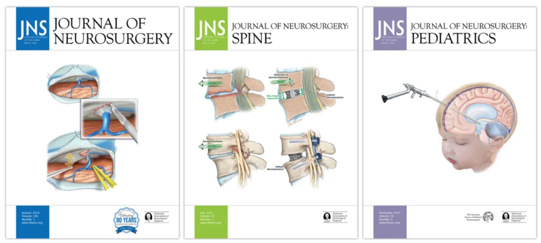 JNS、JNS：脊柱和JNS：儿科的精选封面和封面人物。这些封面展示了期刊重新设计、主要艺术作品的使用、80周年标志的融入，以及与AANS的长期合作关系。