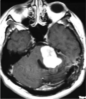 影像学检查显示肿瘤显著增大