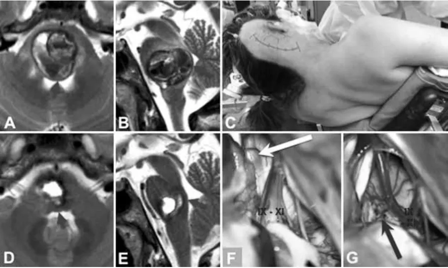 从“瘫痪昏迷”到“重返生活”