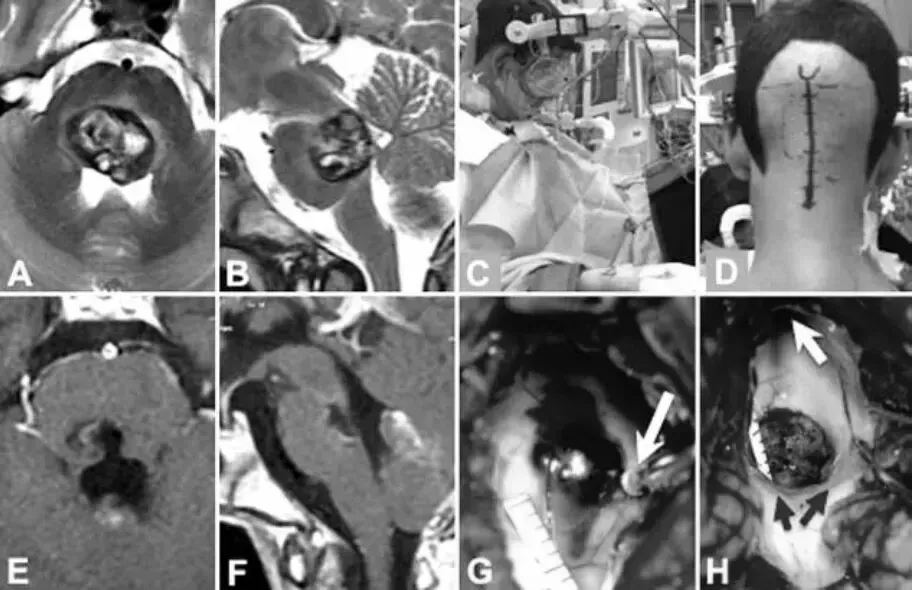 与“面瘫”擦肩而过