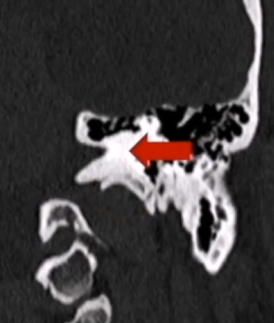 术前精准评估。