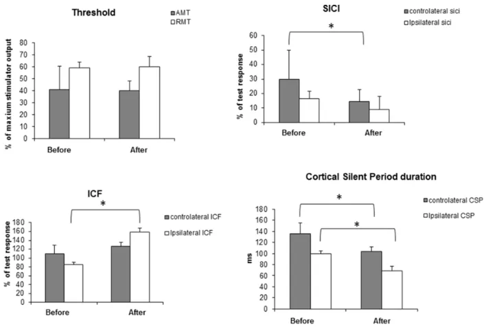 图4.直方图显示了通过单脉冲及成对脉冲TMS对左侧运动皮层进行刺激、并于双侧记录到的术前及术后神经生理学检查结果。 术后，对侧短间隔皮层内抑制和同侧皮层内易化增加。术后，对侧及同侧皮层静息期均缩短。*p < 0.05，显著性水平。