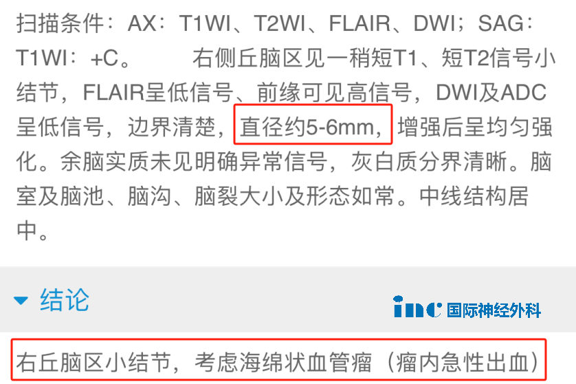 右侧丘脑，一个直径约5~6mm的海绵状血管瘤。