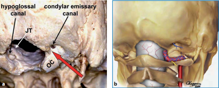 枕骨大孔区，从右背外侧和下角观察颅骨（a）和右背外侧颅骨区图示（b）