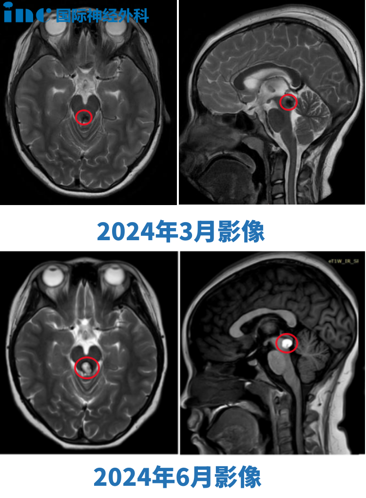 术前术后影像对比