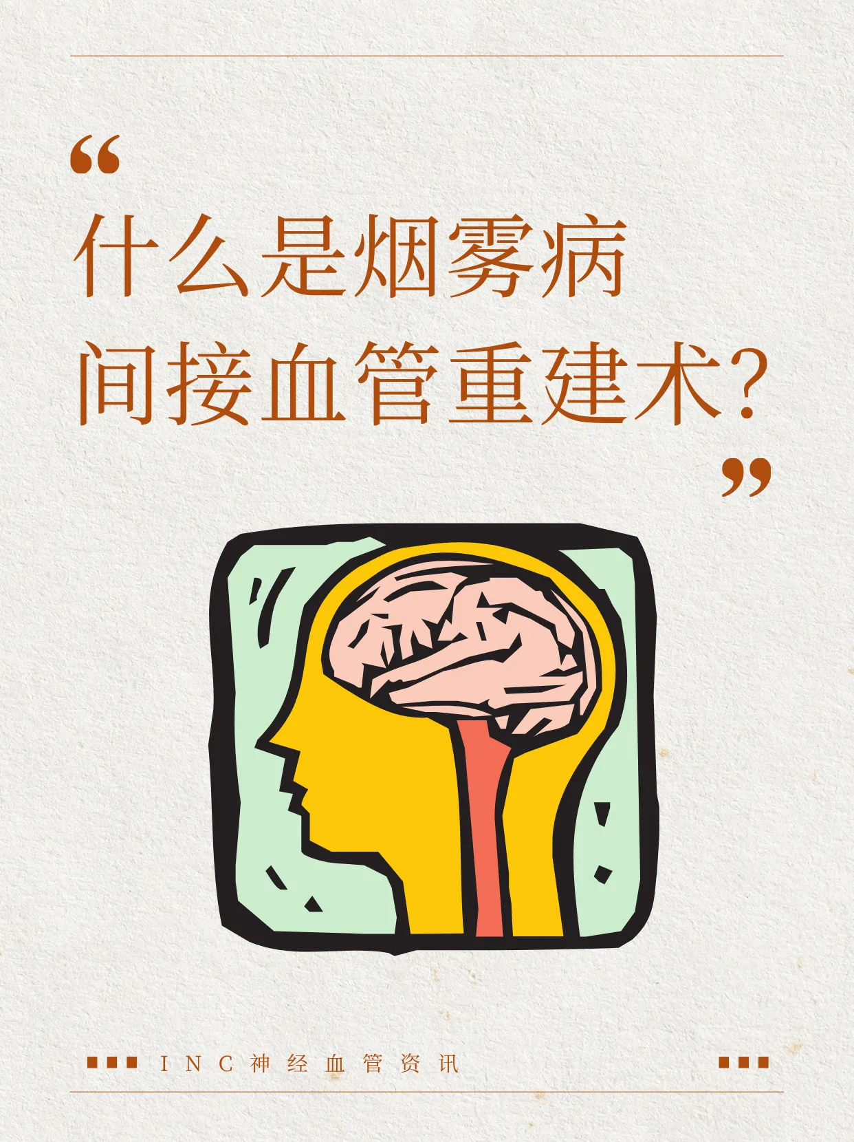 烟雾病间接血管重建术