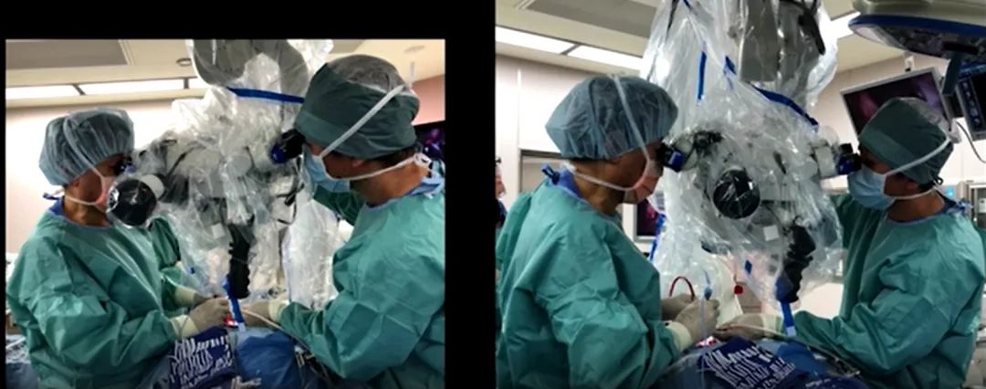 双人四手联合手术