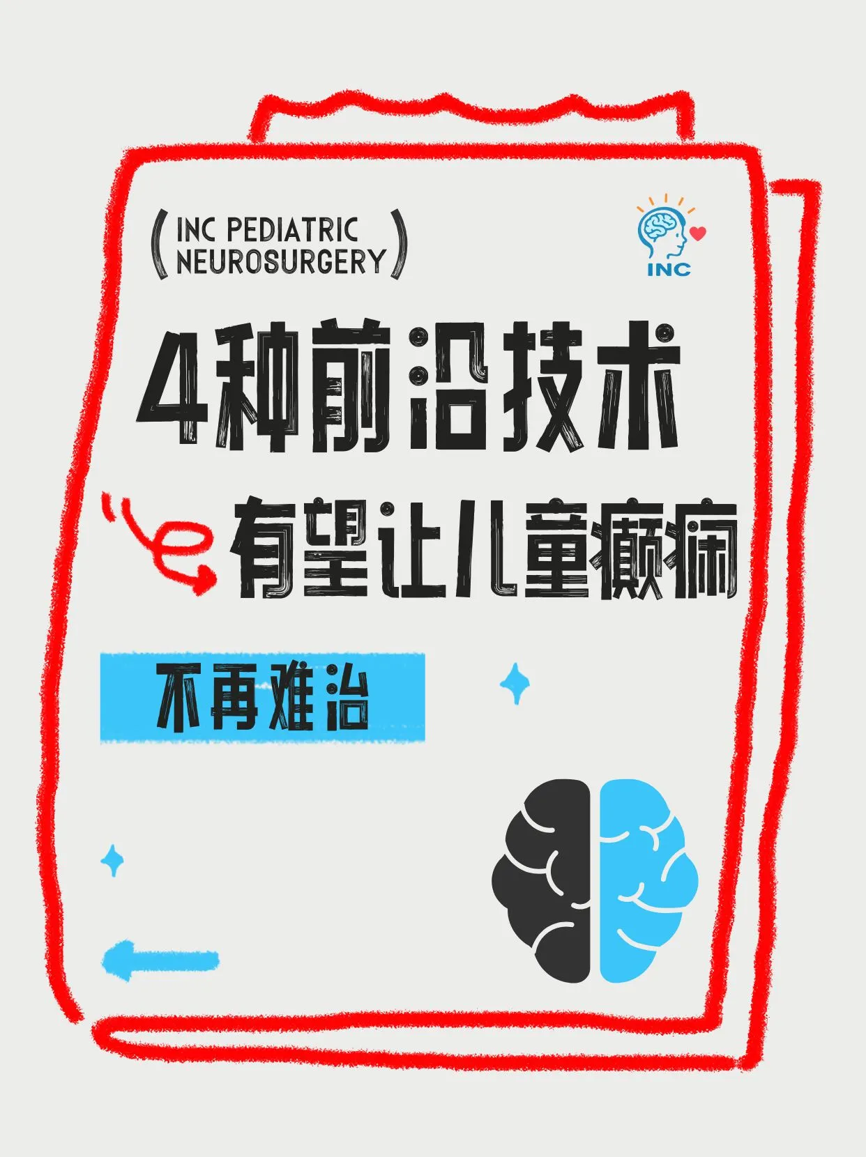 这4种技术有望让儿童癫痫不再“难治”