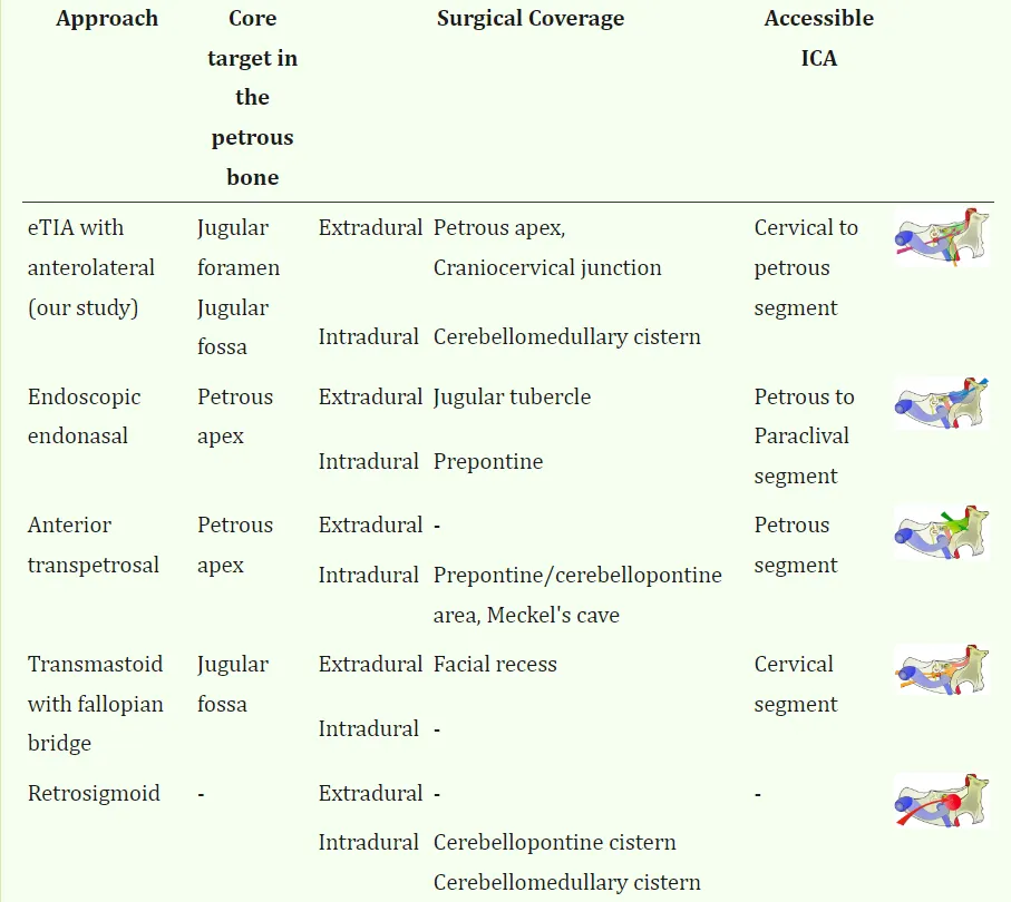 岩骨病变手术入路的策略选择