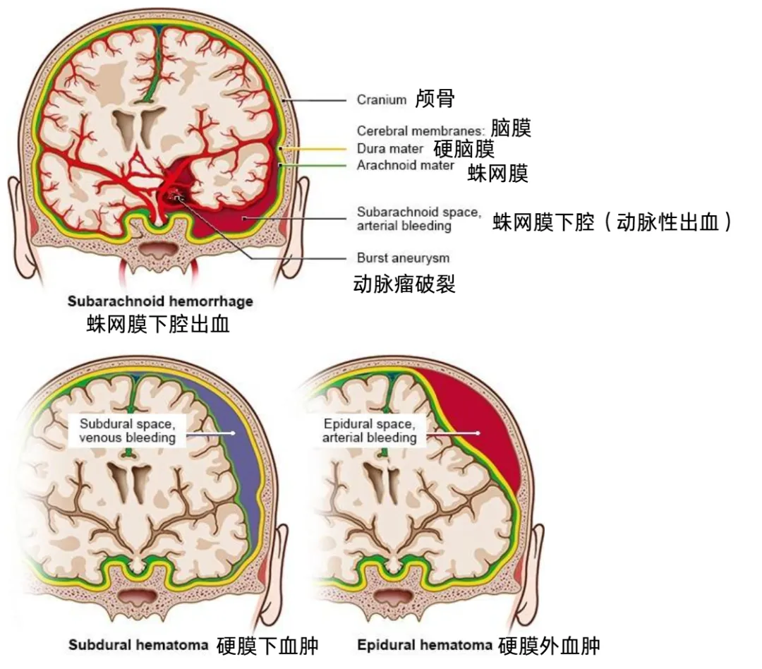 发生率极低，  但死亡率极高