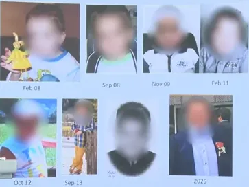 他的视路胶质瘤得到了肉眼全切，而且术后也不会影响孩子的正常生活。