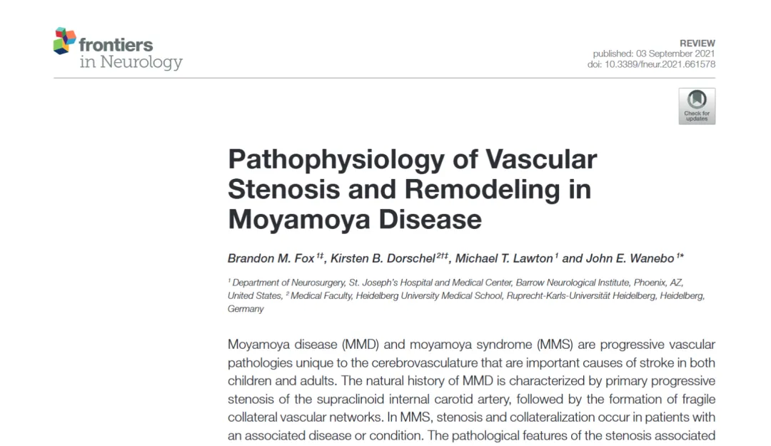 烟雾病是儿童与成人缺血性卒中、脑出血的重要原因之一。