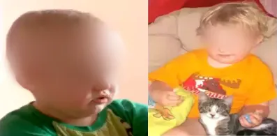 年仅2岁就要因胶质瘤变盲？一台“都说不行”的手术保住了他