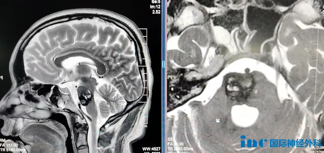 紧急出血的27岁青年
