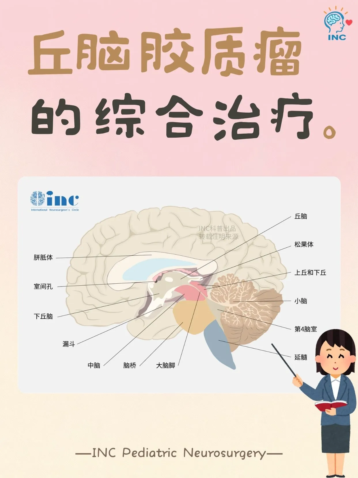 NF1合并丘脑胶质瘤