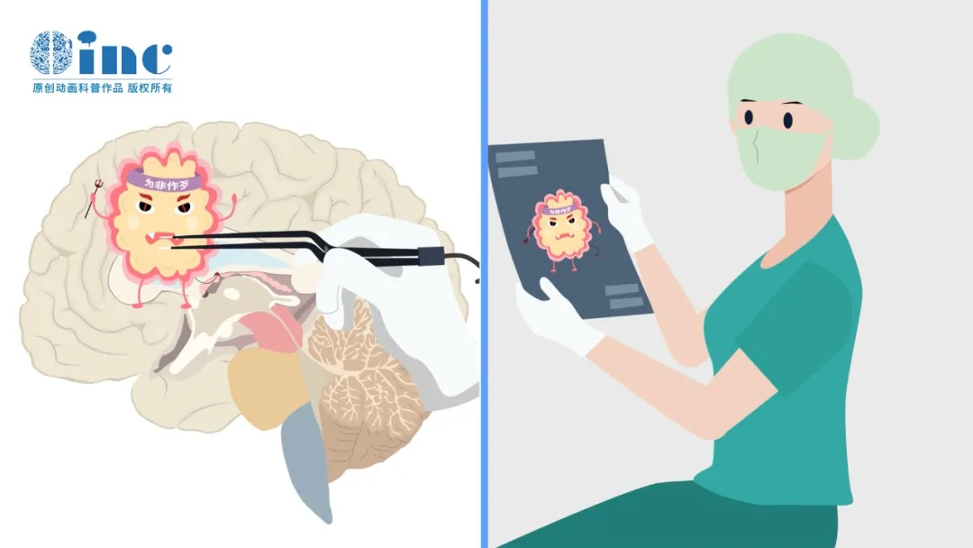 术后抗癫痫药吃多久