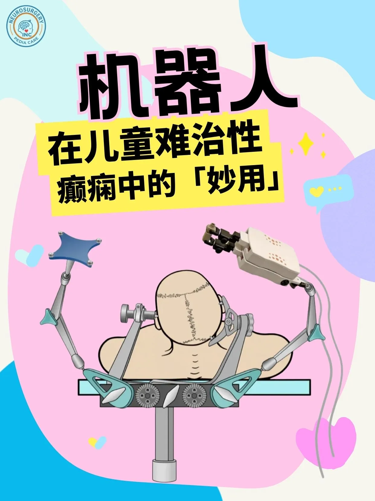 机器人癫痫手术