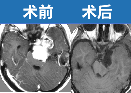 与脑干胶质瘤抗争的这条路，我们一直走到现在，坚持了29年，往后也会一直抗争下去的！