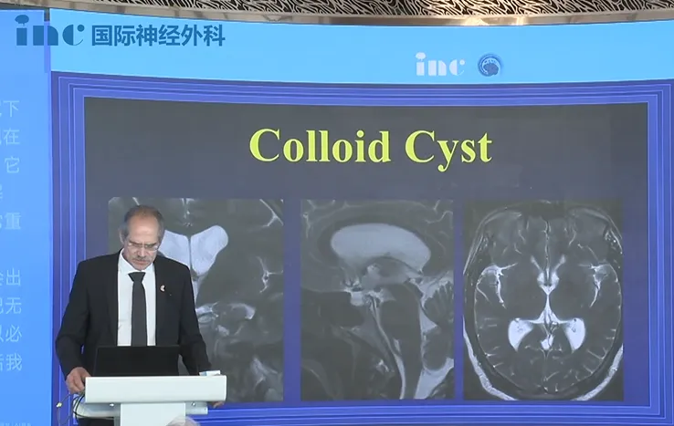 不要拉扯，否则会出现大量出血。