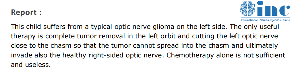 对于糖糖的状况,手术即使全切,术前已经丧失的视力也无法还原,仅能保留眼球运动。