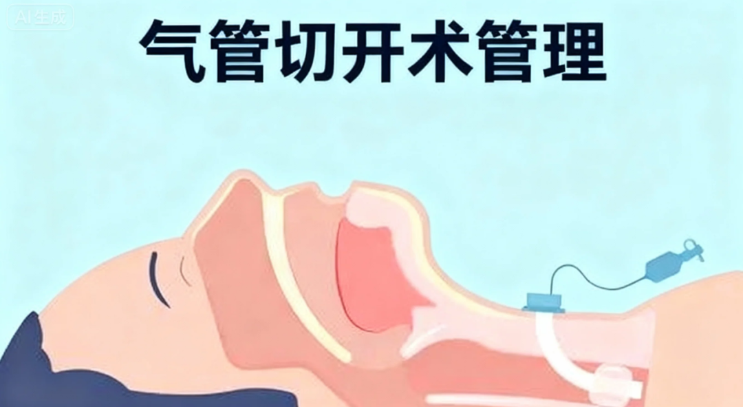 气管切开术管理
