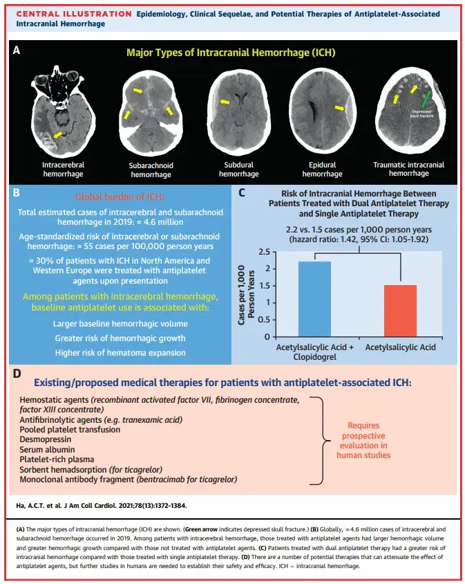 Intracranial Hemorrhage During Dual Antiplatelet Therapy