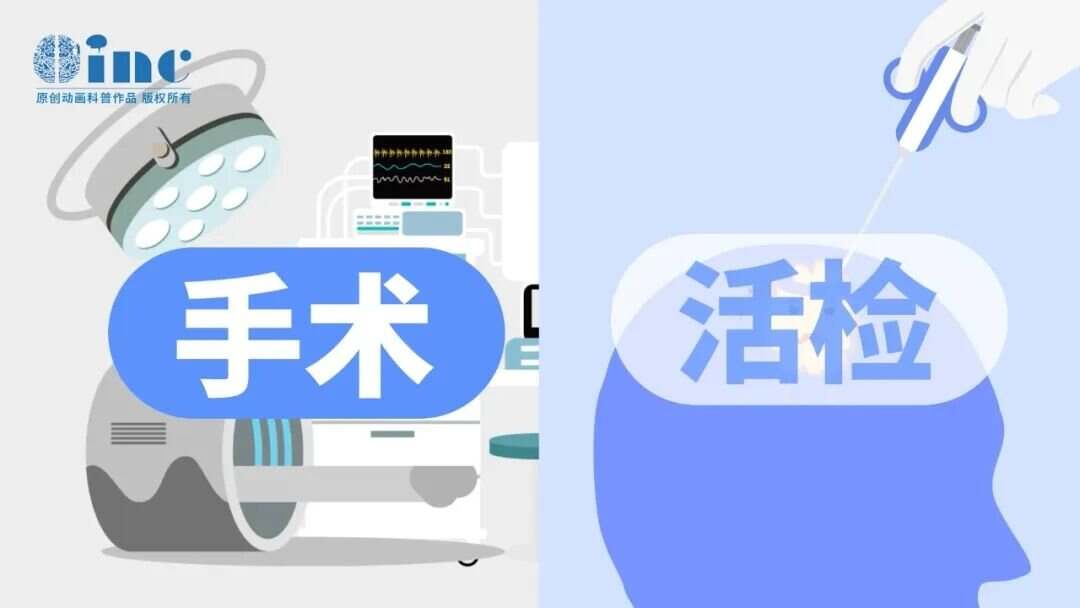 脑肿瘤一定要手术吗