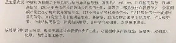 放射学表现桥脑后方延髓后上部见斑片结节异常信号影,范围约8.1 * 6.1mm,T1WI稍高信号,FLARI高信号,DWI呈中央低信号伴边缘少许高信号影,增强后内部见强化血管影伸入,余双侧额叶见散在小斑片状异常信号灶,T1W不明显呈等和稍低信号,FLAIR病灶信号未被抑制呈高信号,DWI病灶信号未见明显增高。各脑室、脑池及脑沟未见明显增宽、扩大或变窄。中线结构无移位。筛窦粘膜增厚。鼻中隔向左偏曲。双侧鼻甲肥厚。 放射学诊断结合病史,拟脑干海绵状血管瘤伴少许出血:双侧额叶少许腔隙灶;筛窦炎,双侧鼻甲肥厚。请结合临床随访。