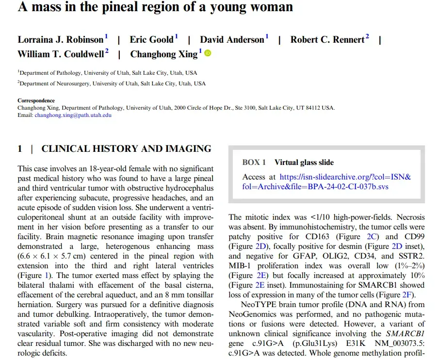 A mass in the pineal region of a young woman