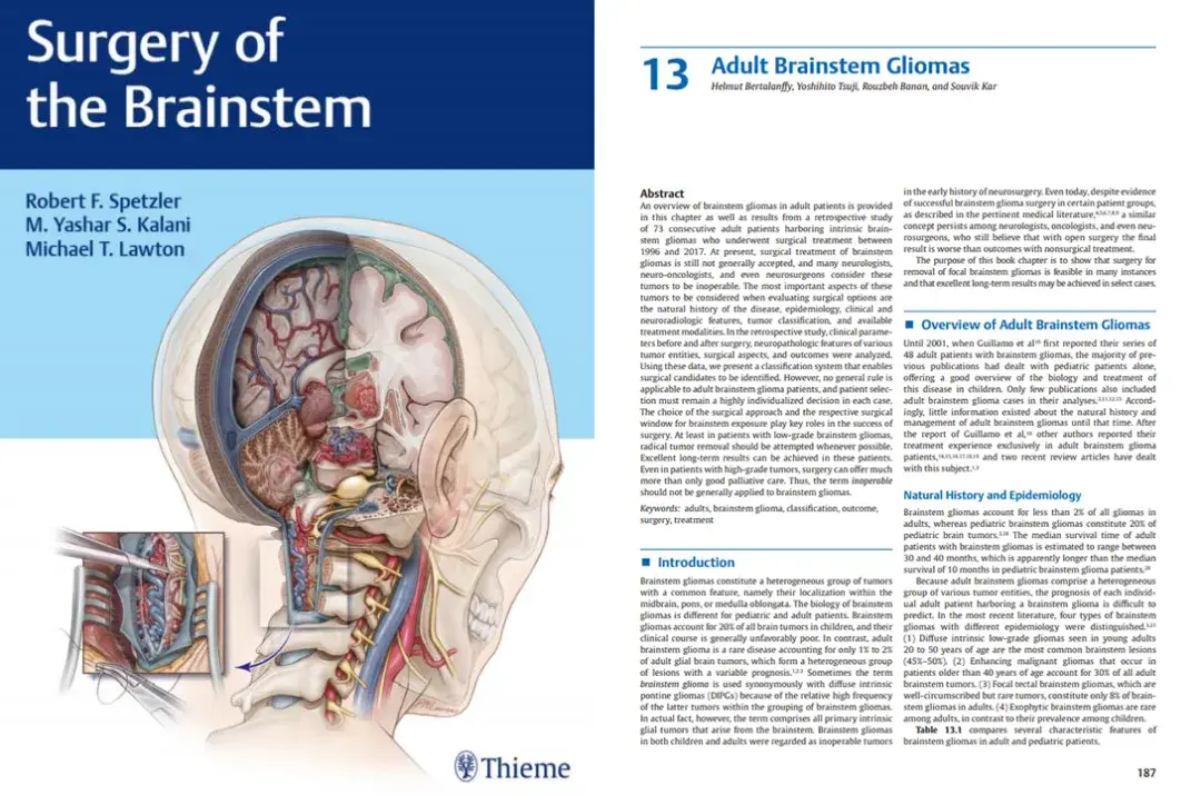  Adult Brainstem Gliomas 