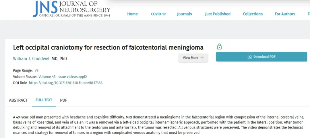 Left occipital craniotomy for resection of falcotentorial meningioma