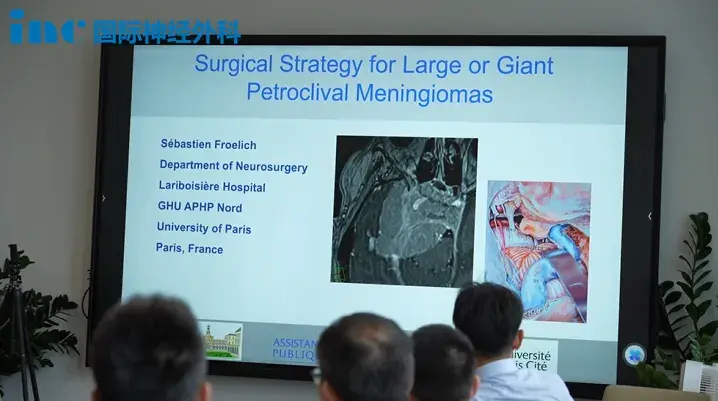 Surgical Strategy for Large or Giant Petroclival Meningiomas