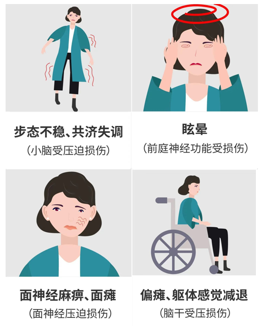 手术风险大,稍有不慎可能就导致同侧面听神经麻痹、小脑性共济失调及脑干损伤。