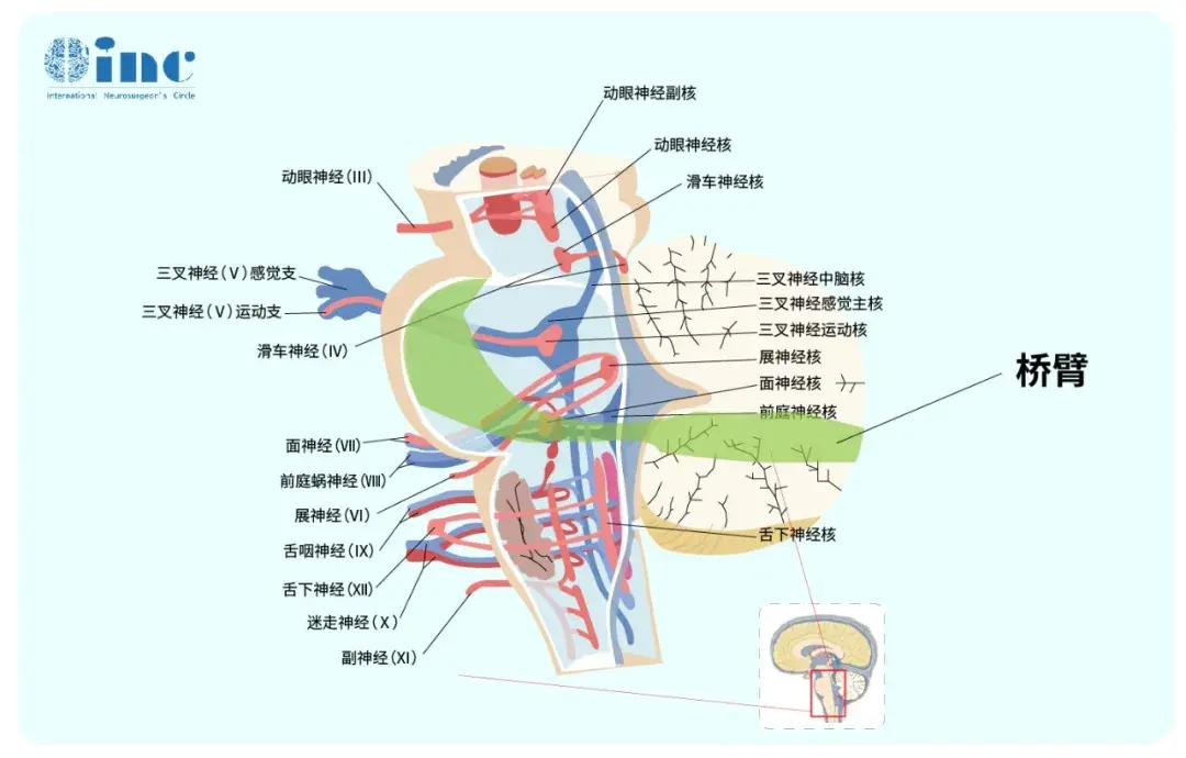 小脑和脑干的连接有上脚、桥臂(中脚)和绳状体(下脚)