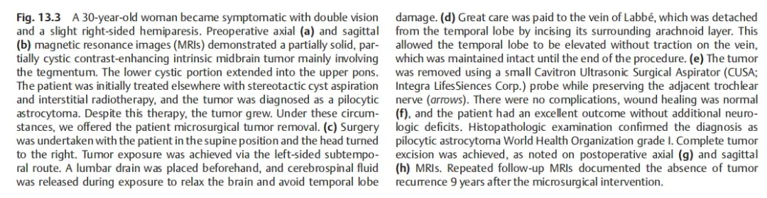 Surgery of the Brainstem