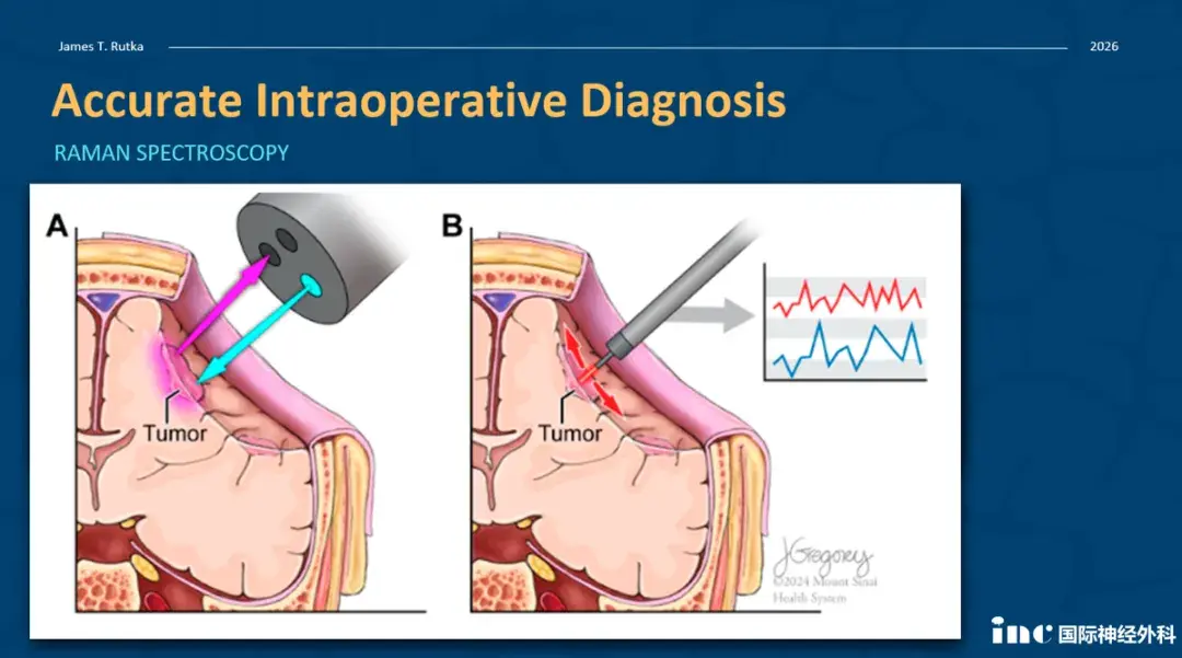 Accurate Intraoperative Diagnosis