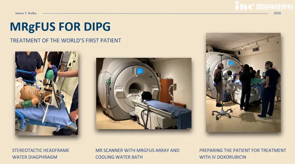 MRgFUS FOR DIPG  TREATMENT OF THE WORLD'S FIRST PATIENT